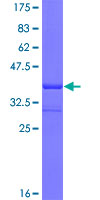 12.5% SDS-PAGE Stained with Coomassie Blue.
